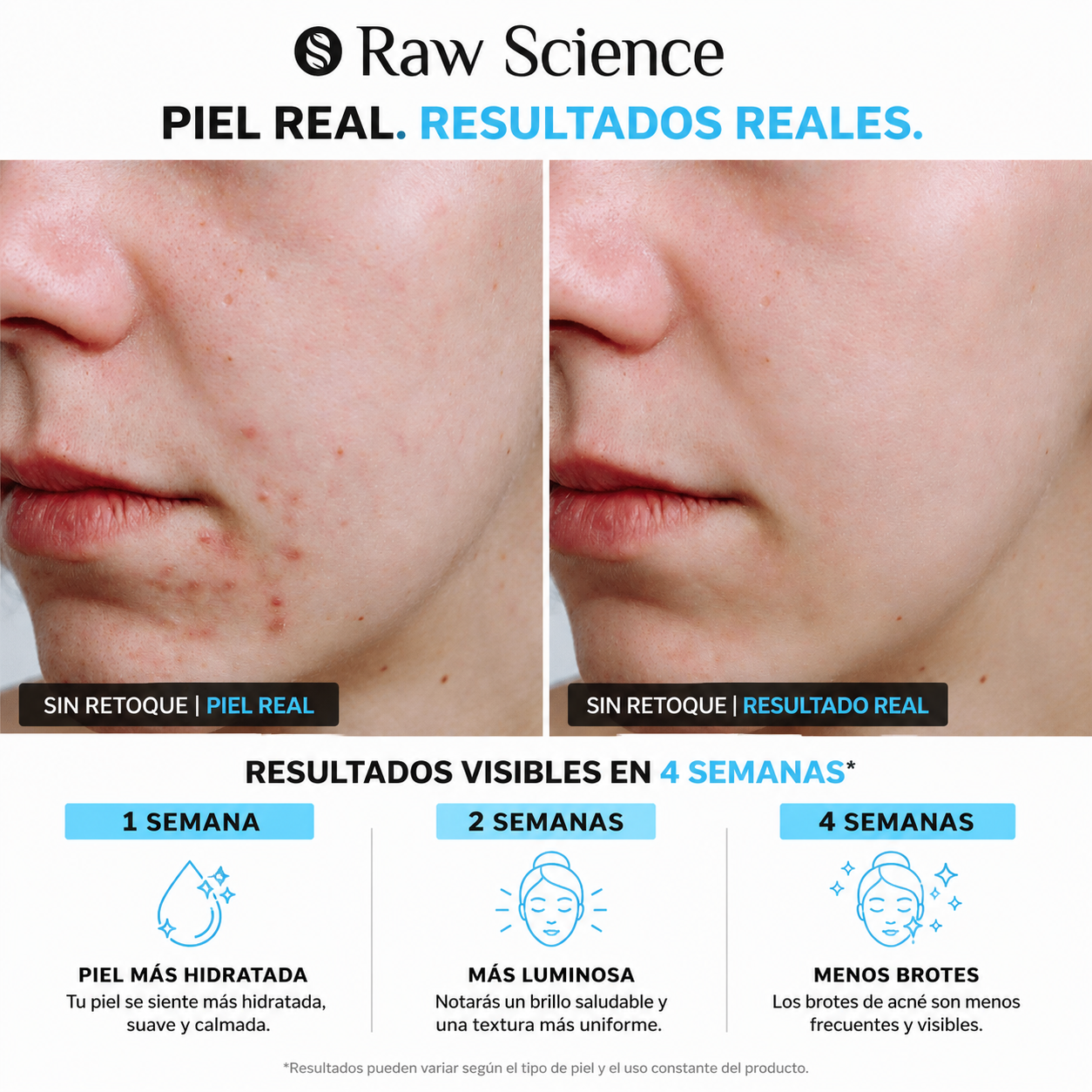 Clear Skin Formula