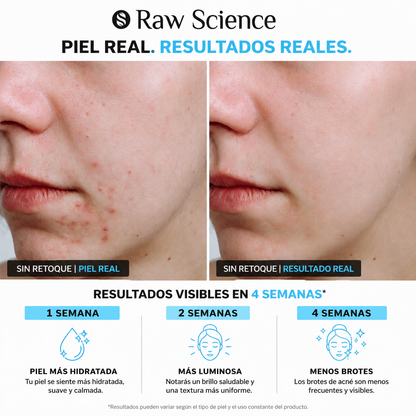 Clear Skin Formula